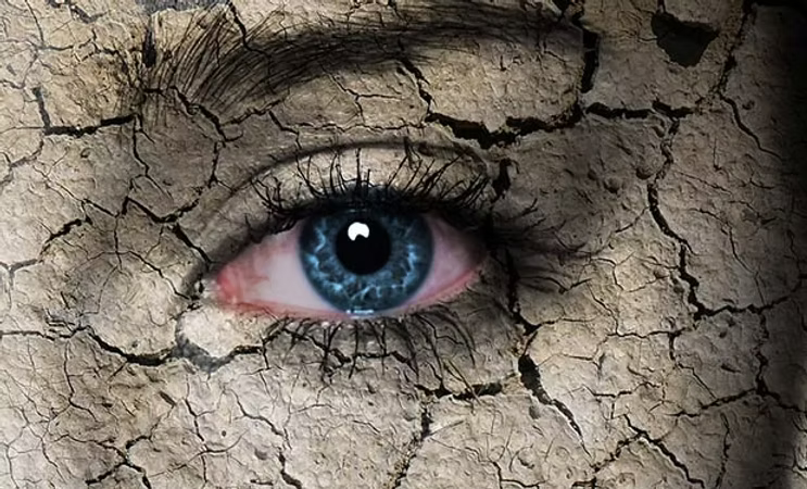 La sécheresse oculaire