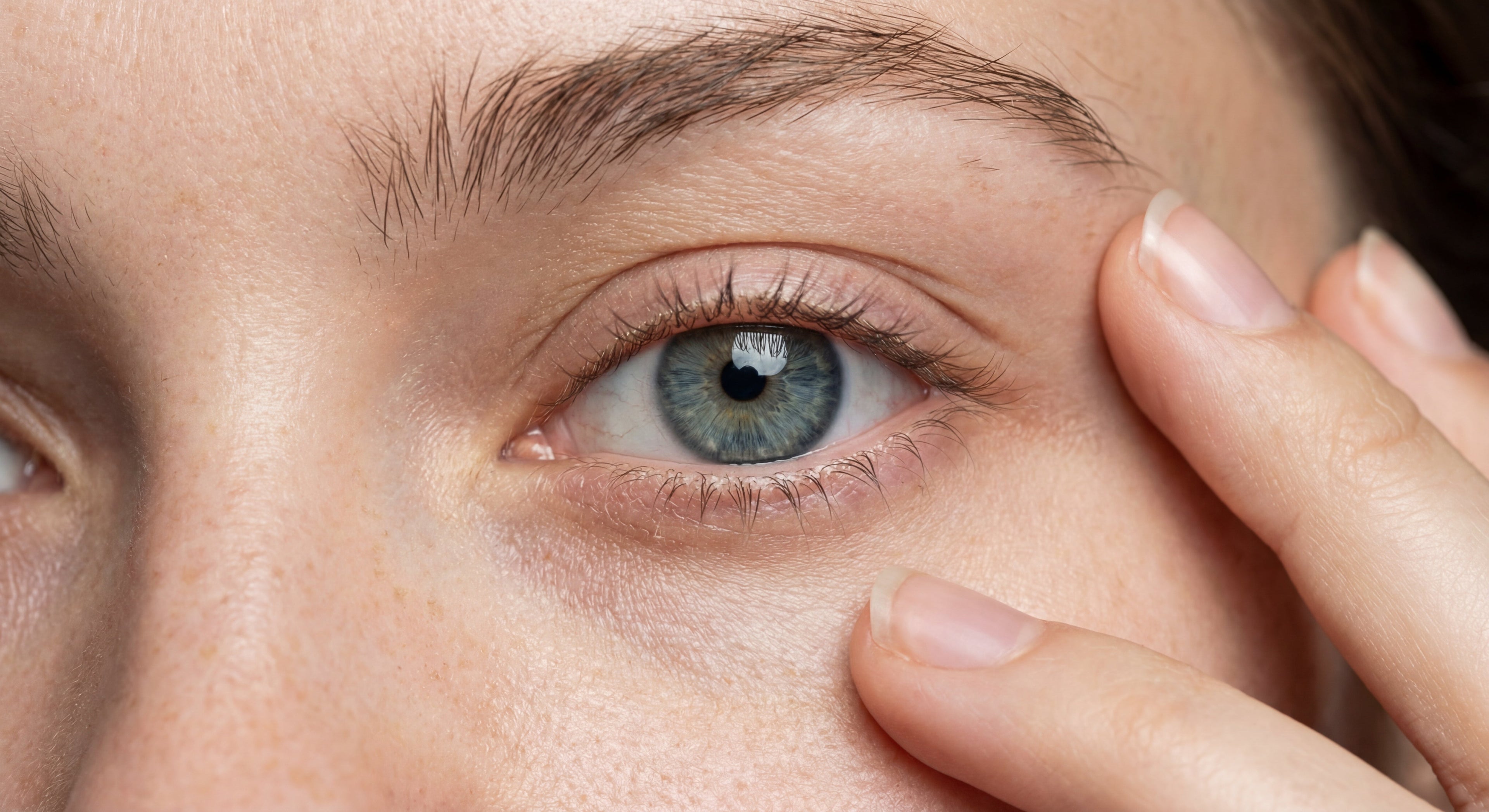 Allergie oculaire : comprendre, soulager et protéger vos yeux